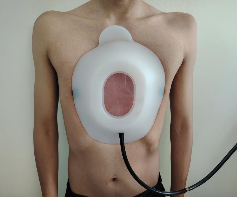 Vacuum Bell - En uso